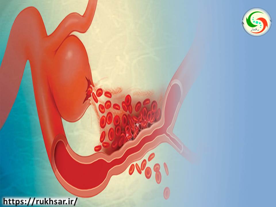 محققان به روشی جایگزین برای عمل هیسترکتومی دست یافتند